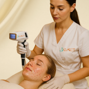laser antiacne cara.webp